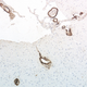 Illustration for article titled Controversial ‘Transmittable Alzheimer’s’ Theory Is Starting to Look Plausible